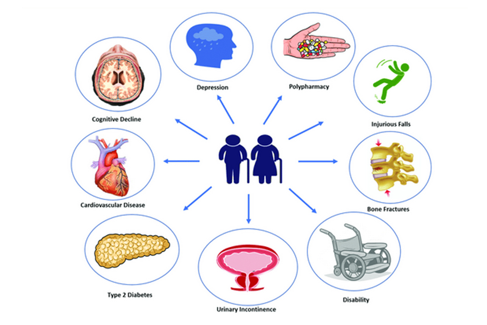 شایع ترین بیماری های مزمن در بزرگسالان مسن کدامند؟